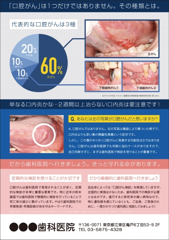 New 口腔がんフライヤー ａ4チラシ 診察券や医療系印刷物のデザイン作成 制作はメディカルランド